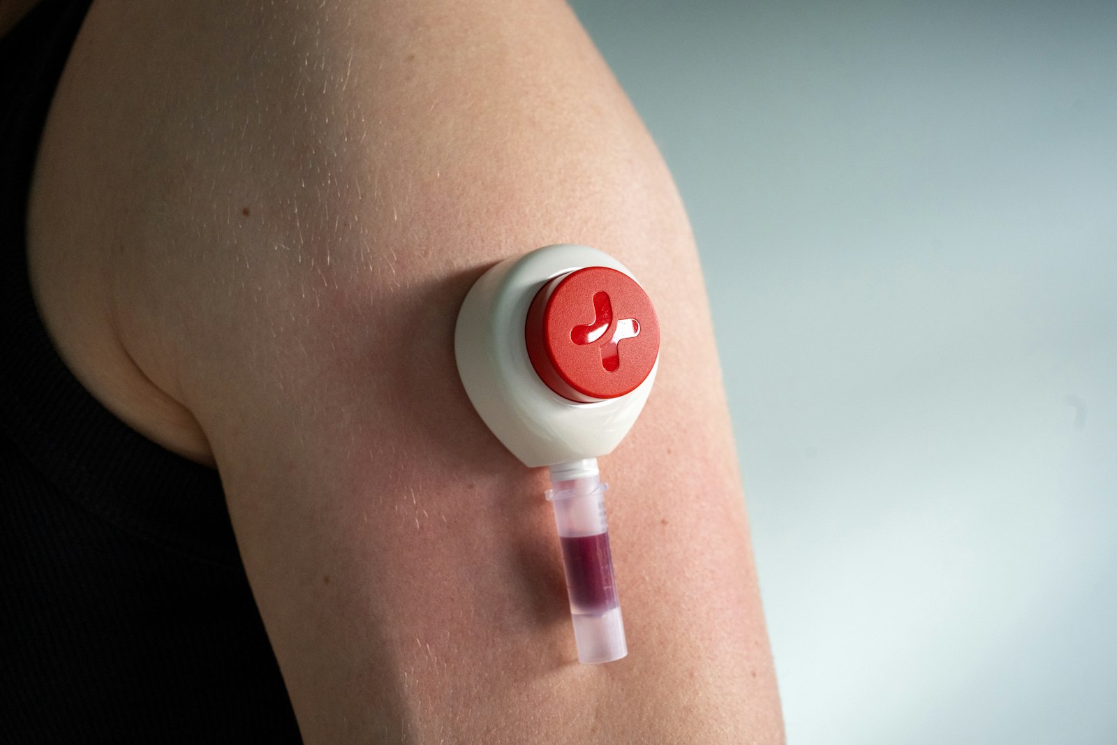 Tasso blood-collection device on an upper arm